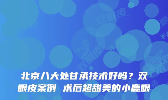 北京八大处甘承技术好吗？双眼皮案例 术后超甜美的小鹿眼