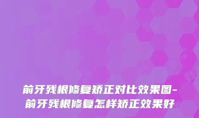 前牙残根修复矫正对比效果图-前牙残根修复怎样矫正效果好