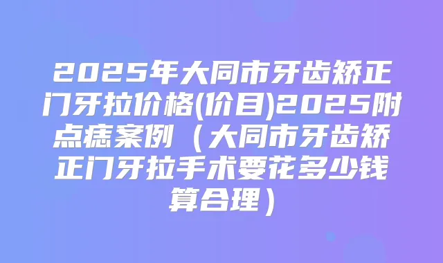 2025年大同市牙齿矫正门牙拉价格(价目)2025附点痣案例(大同市牙齿矫正门牙拉手术要花多少钱算合理)
