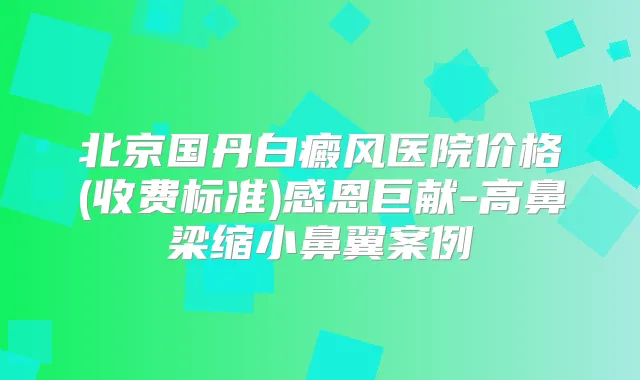 北京国丹白癜风医院价格(收费标准)感恩巨献-高鼻梁缩小鼻翼案例