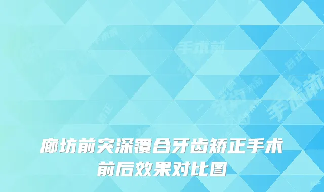 廊坊前突深覆合牙齿矫正手术前后效果对比图