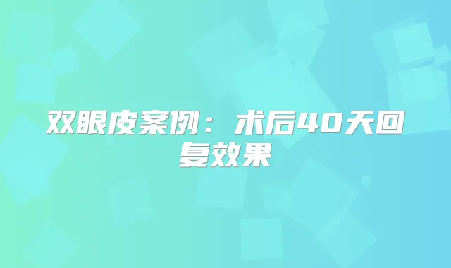 双眼皮案例：术后40天回复效果