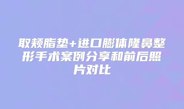 取颊脂垫+进口膨体隆鼻整形手术案例分享和前后照片对比