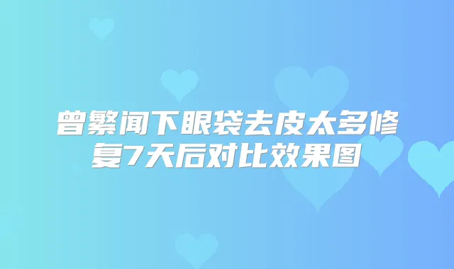 曾繁闻下眼袋去皮太多修复7天后对比效果图