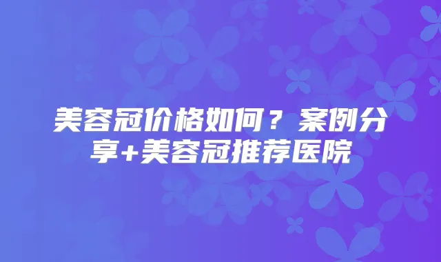 美容冠价格如何?案例分享+美容冠推荐医院