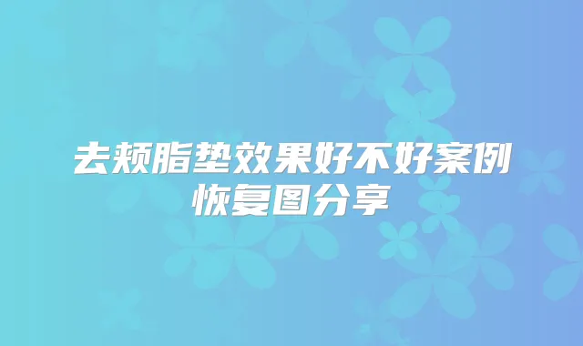 去颊脂垫效果好不好案例恢复图分享