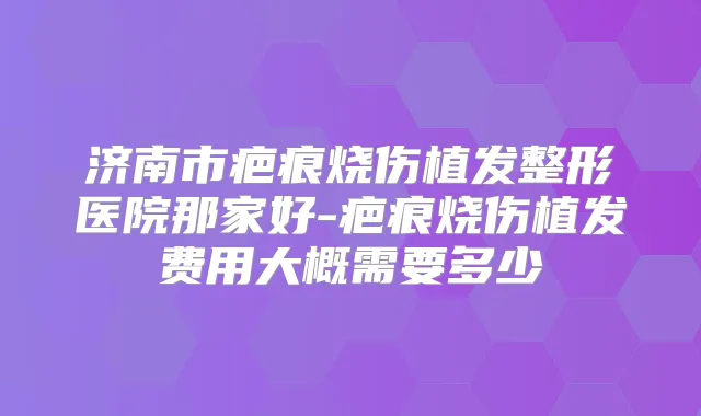 济南市疤痕烧伤植发整形医院那家好-疤痕烧伤植发费用大概需要多少