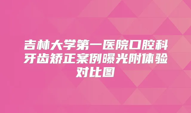 吉林大学第一医院口腔科牙齿矫正案例曝光附体验对比图