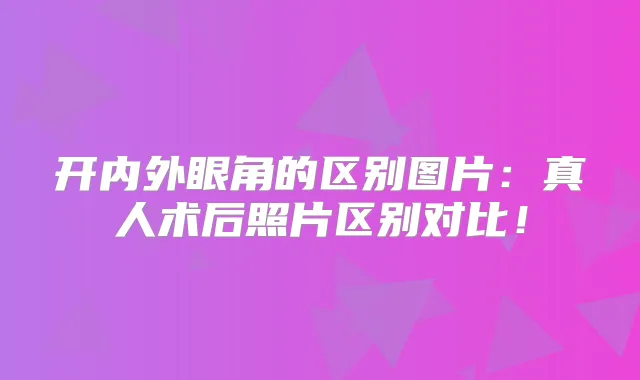 开内外眼角的区别图片:真人术后照片区别对比!