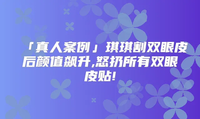 「真人案例」琪琪割双眼皮后颜值飙升,怒扔所有双眼皮贴!